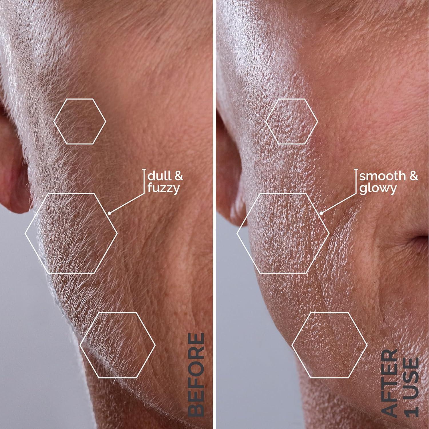 image:imageMichael Todd Beauty Sonicsmooth SONIC Technology Dermaplaning Tool 2 in 1 Womens Facial Exfoliation amp Peach Fuzz Hair Removal System with 8 Weeks of Dermaplaning Blades