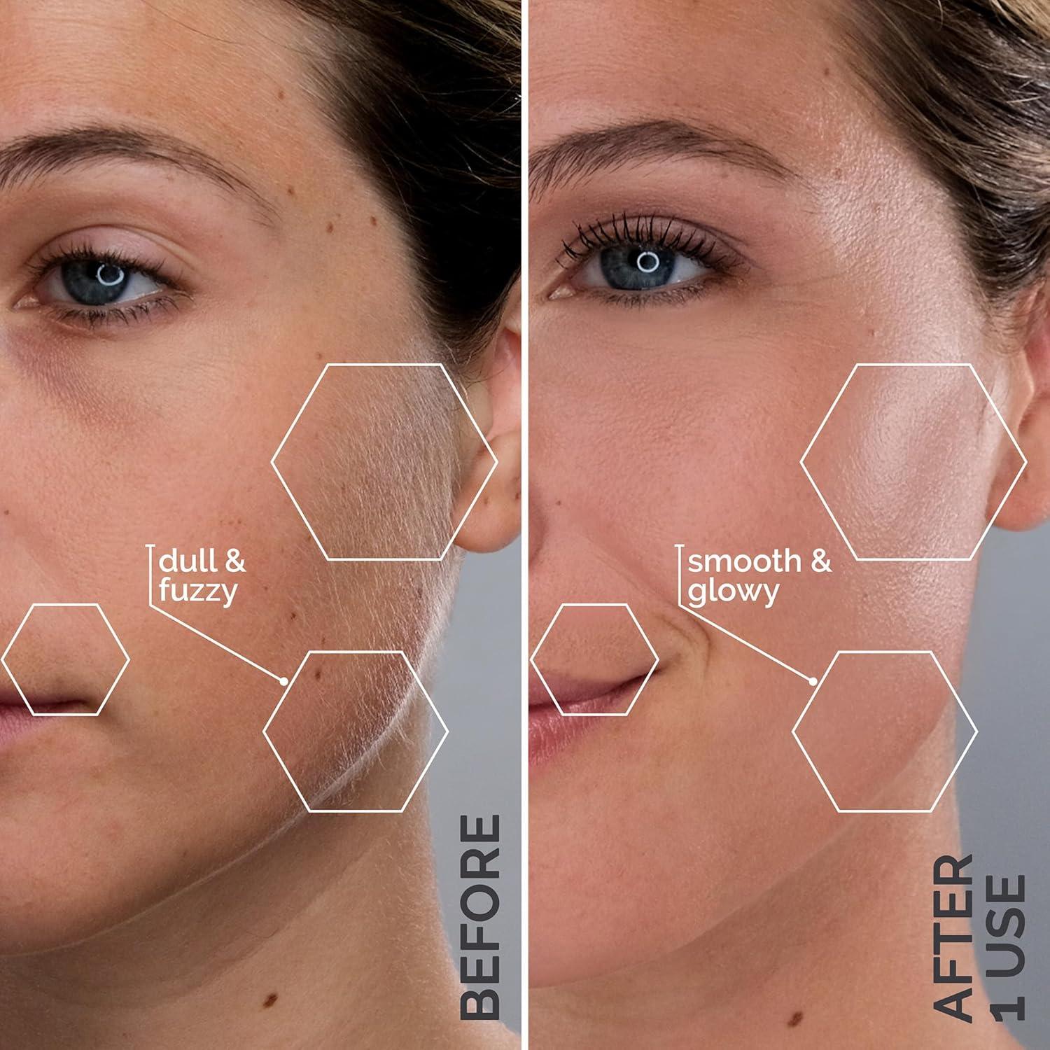 image:imageMichael Todd Beauty Sonicsmooth SONIC Technology Dermaplaning Tool 2 in 1 Womens Facial Exfoliation amp Peach Fuzz Hair Removal System with 8 Weeks of Dermaplaning Blades