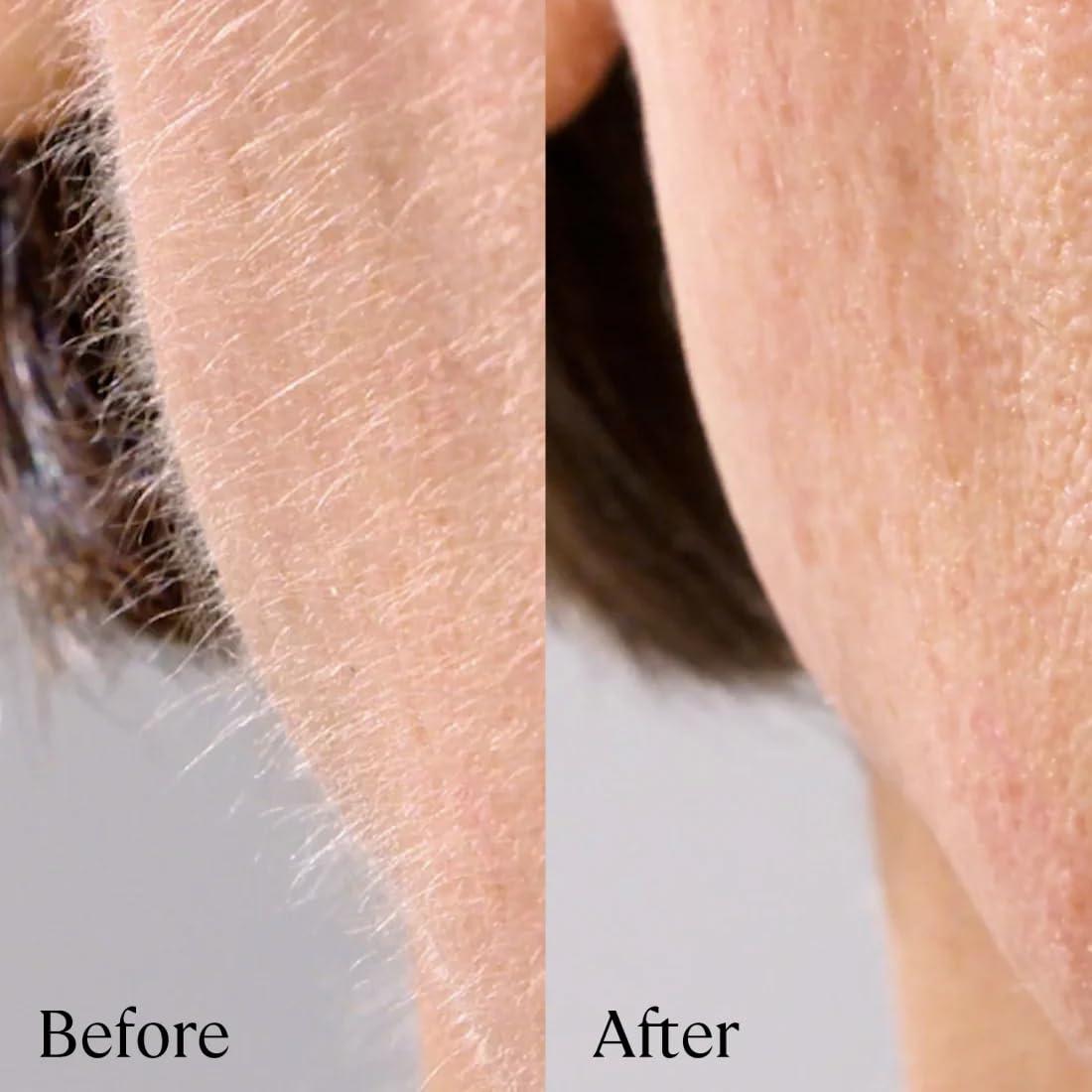 image:imageMichael Todd Beauty Sonicsmooth Pro Dermaplaning Blade Refills 8 Dermaplaning Blades 2 Month Supply Device Not Included8 Pack Safety Tips