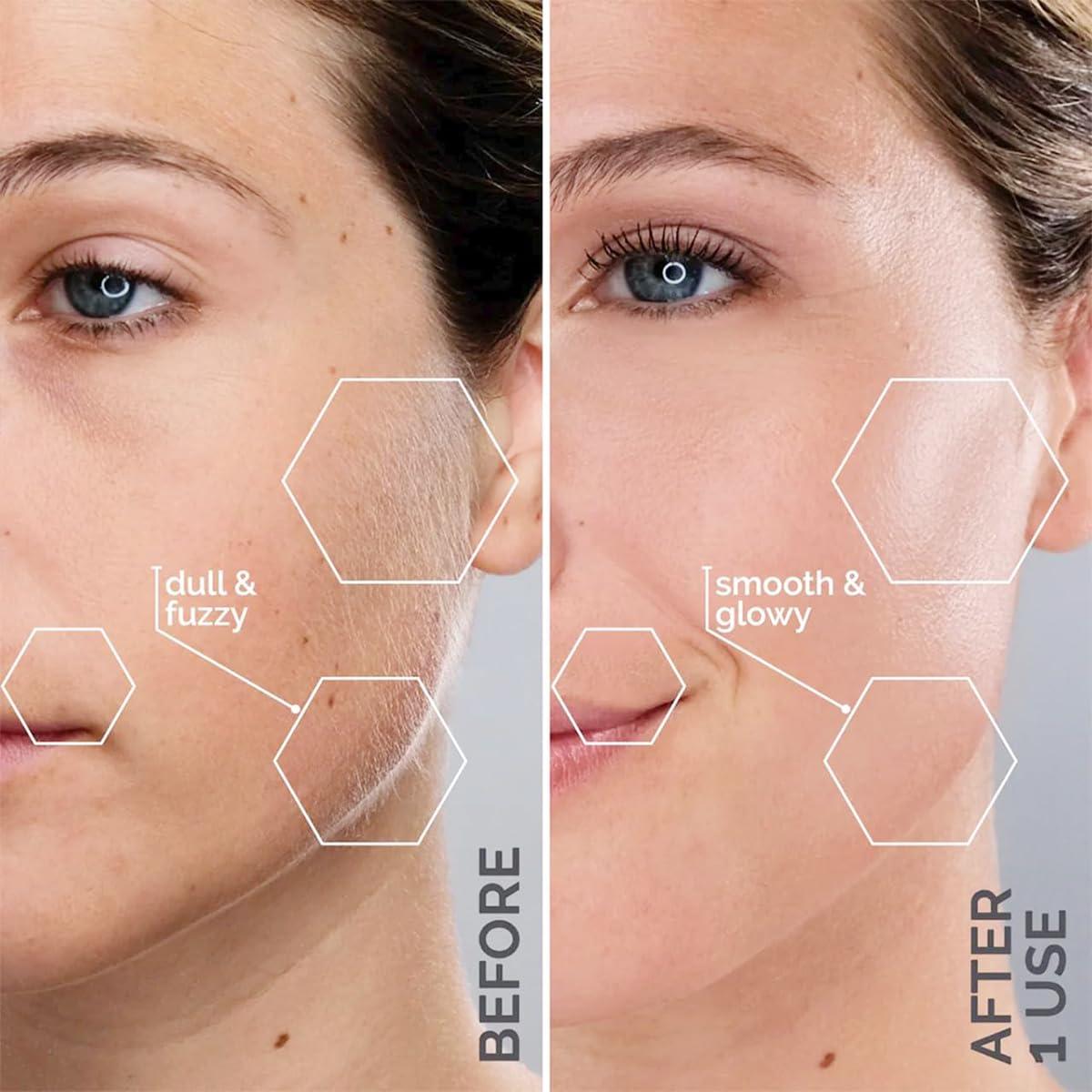 image:imageMichael Todd Beauty Sonicsmooth Pro Dermaplane Razor for Women Face Eyebrow trimmer Dermaplaning System wLED Light Peach Fuzz Remover 16 Dermaplaning Blades amp 2 Microsmooth Exfoliation TipsPink